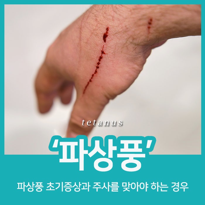 파상풍 초기증상과 주사를 맞아야 하는 경우는 언제일까? : 네이버 블로그