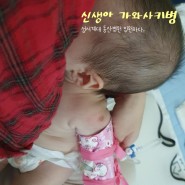 가와사키병 진단 동산병원 입원후기,100일아기 3개월아기 신생아 고열 응급실행
