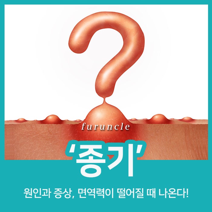 면역력이 떨어질 때 나오는 종기 발생원인과 증상은? : 네이버 블로그