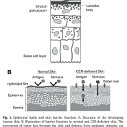 피부 장벽(스킨 배리어, Skin barrier)의 중요성과 세라마이드(Ceramide)의 기능