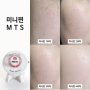 미니핀MTS 1달 사용후기_건성피부, 모공, 피부결 변화
