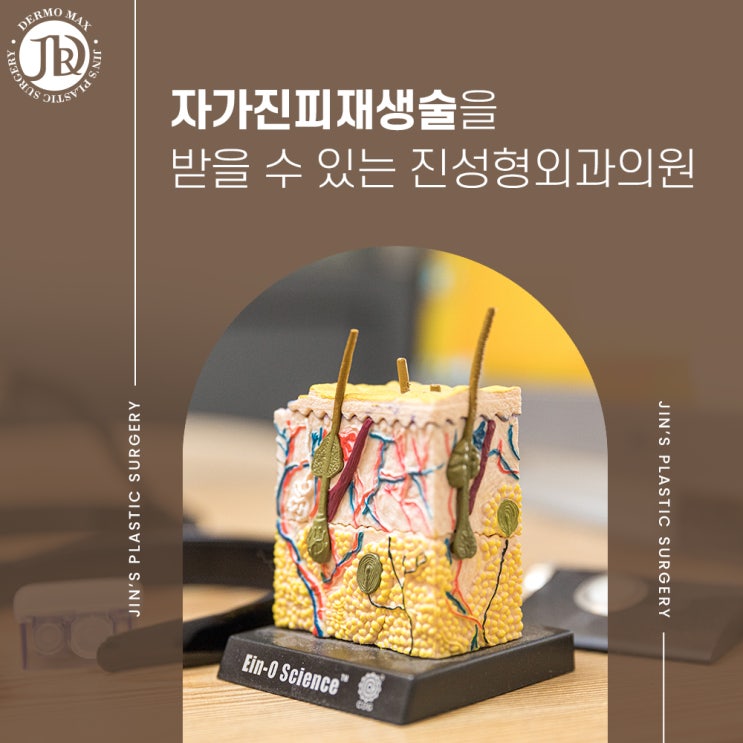 자가진피재생술을 받을 수 있는 진성형외과의원 : 네이버 블로그