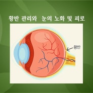 황반 관리와 눈의 노화 및 피로