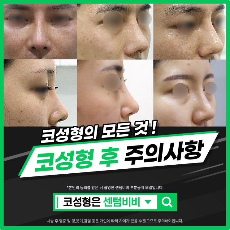 센텀비비 코성형의 모든 것 ! 코성형 후 주의사항 : 네이버 블로그