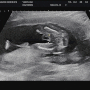예비연년생맘❤️ 임신 16주, 형제맘 확정🤣
