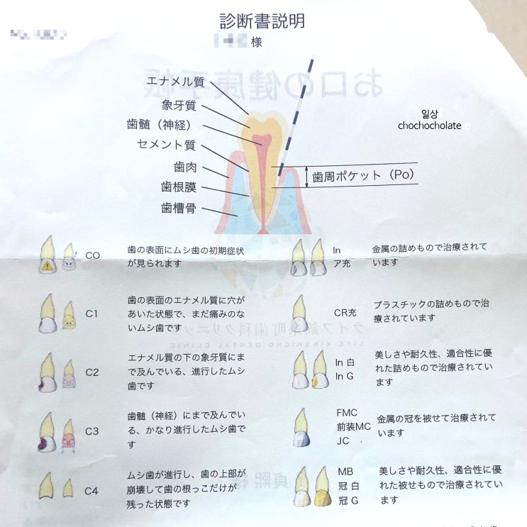 일본 치과 치료 진료비, 임플란트 개비쌈 : 네이버 블로그