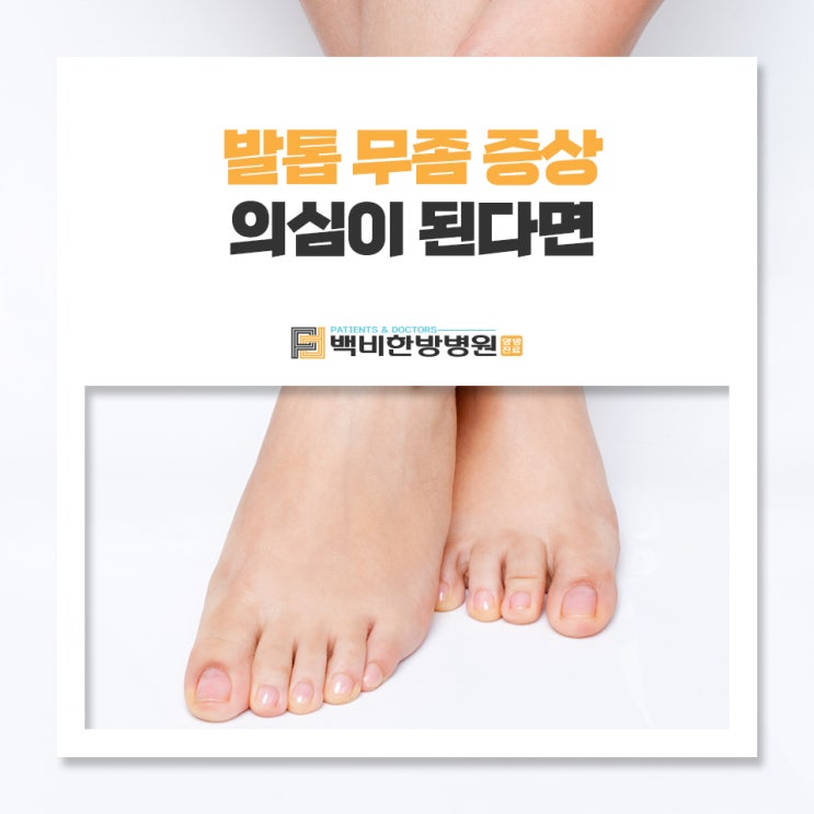 발톱 무좀 증상 의심이 된다면 : 네이버 블로그