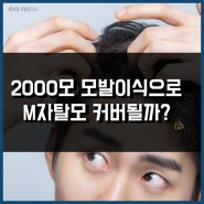 2000모 모발이식으로 M자탈모 커버될까?