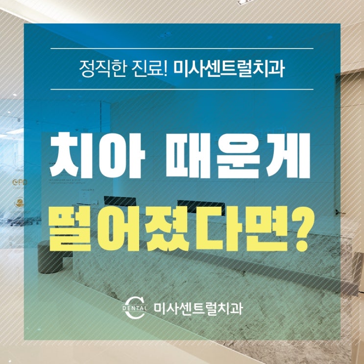 [미사치과] 치아 때운 게 빠졌을때, 어떻게 대처해야 할까? : 네이버 블로그