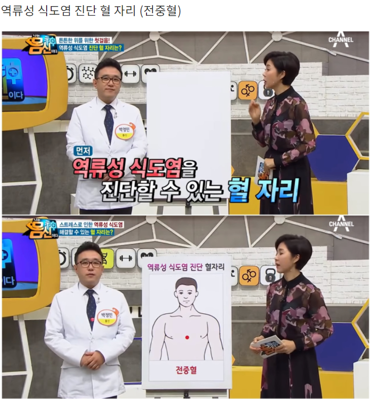 역류성 식도염 진단하는 혈 자리 : 네이버 블로그