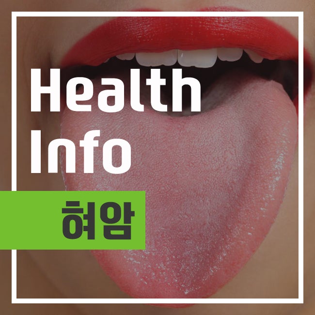 구강암 혀암 설암 초기 증상 및 원인, 치료 예방 : 네이버 블로그