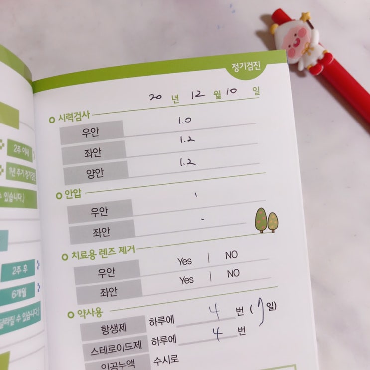 스마일 라식 6개월차 후기/ 부작용 및 장단점 : 네이버 블로그