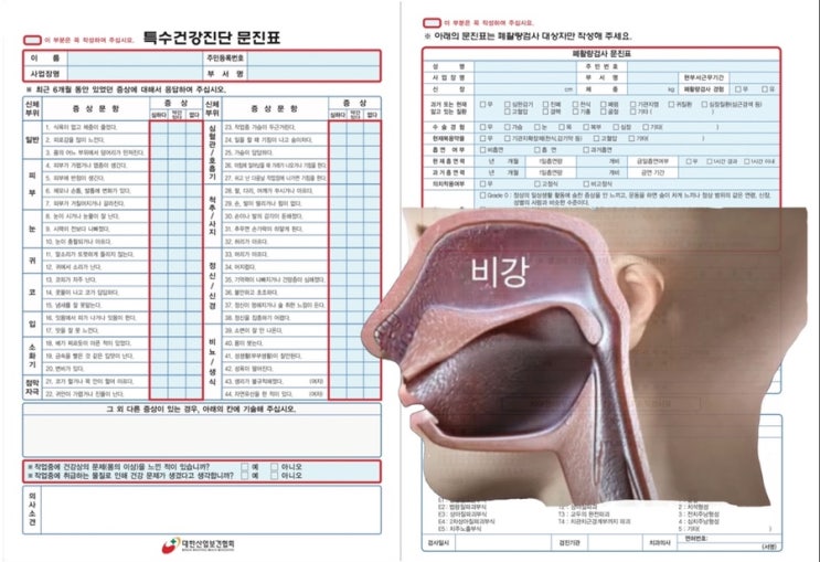 [산재사고]후각손실장해, 후각장애 보상과 배상(1) 후각장애 유발요인과 특수건강진단 : 네이버 블로그