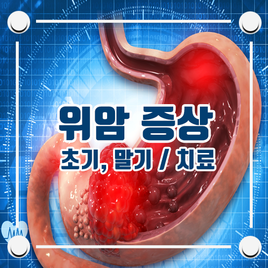위암초기증상 말기증상 및 위암 생존율과 치료 : 네이버 블로그