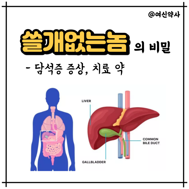 쓸개 담석증 원인 증상 및 치료 약 - 우루사 와의 관계 (+ 씨앤유캡슐) : 네이버 블로그 쓸개 담석증 원인 증상 및 치료 약 - 우루사 와의 관계 (+ 씨앤유캡슐) : 네이버 블로그