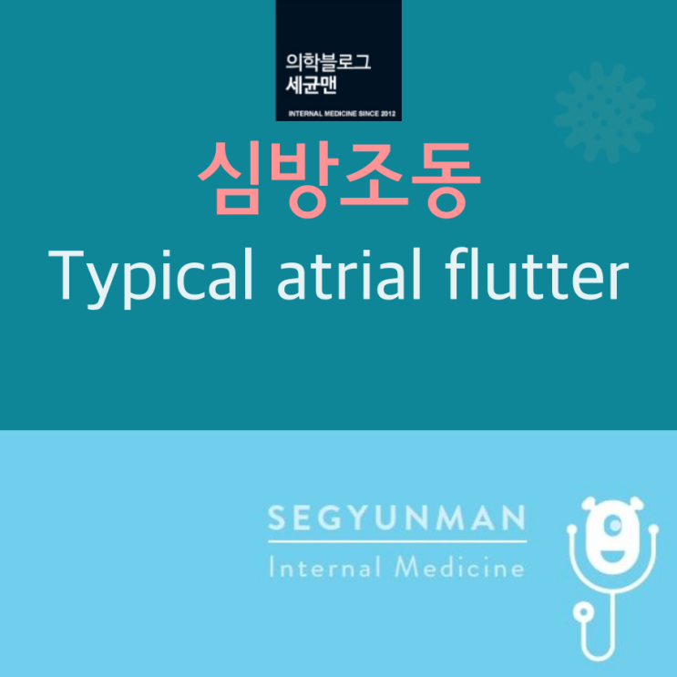심방조동 : Typical atrial flutter (counterclockwise/clockwise circuit ...