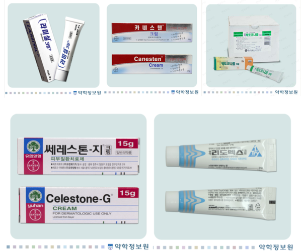 여름철 피부 곰팡이 질환 / 백선 완선, 무좀 증상과 치료 연고 / 가려움, 일상관리방법 : 네이버 블로그
