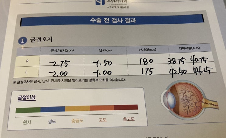 스마일라식 , 강남 수연세안과 검안후기 : 네이버 블로그 스마일라식 , 강남 수연세안과 검안후기 : 네이버 블로그