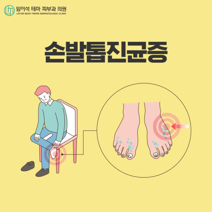 손발톱진균증, 효과적인 치료법은? : 네이버 블로그