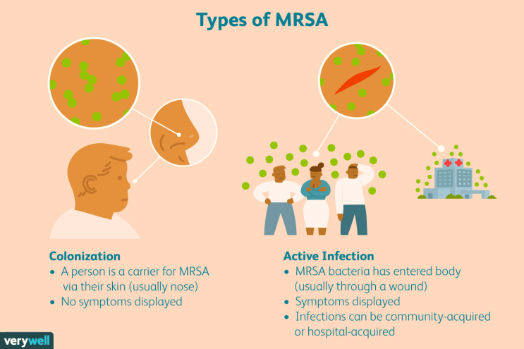 antimicrobial-action-of-autologous-platelet-rich-plasma-on-51-off