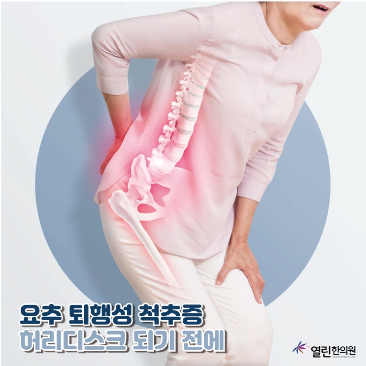 요추 퇴행성 척추증 허리디스크 되기 전에 : 네이버 블로그