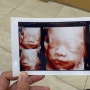 임신28주 나무정원 입체초음파 임신8개월증상 공유해요