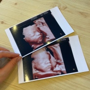임신일기 26주 : 임당검사 입체초음파 (임당통과)