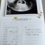 임신8주/폭풍하혈/덩어리하혈/쌍각자궁/임신10주