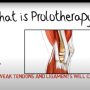 프롤로치료란? (동영상 소개)