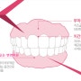 [전주 박앤박치과] 유리치은이식술 (FGG)에 대해서