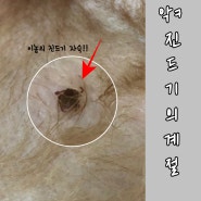 진드기가 싫어하는 에센셜오일이 들어간 해충방지 스프레이 과연 효과가 있을까?