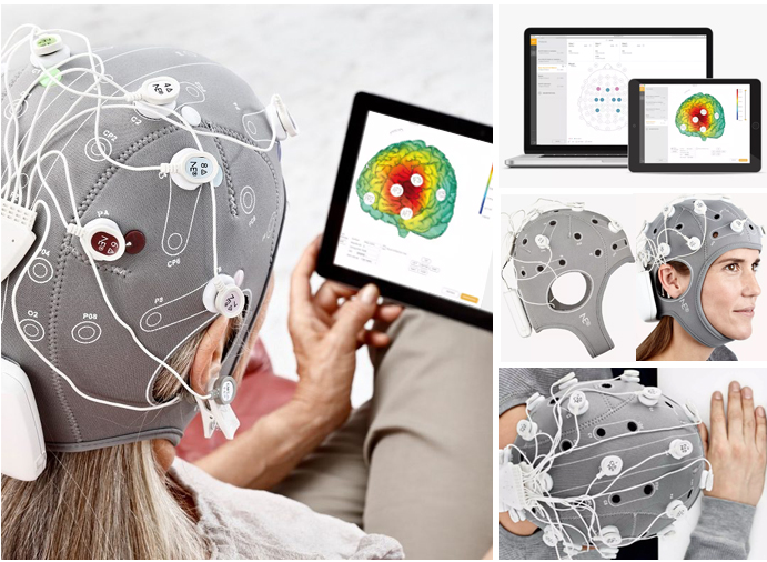 Starstim tDCS 경두개 직류 자극 8 채널 치료 : 네이버 블로그