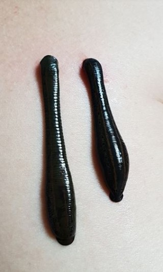 의료용 거머리 주의사항 : 네이버 블로그
