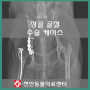 골반 골절 수술 케이스 : 천안 동물병원