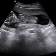 셋째임신: 16주 딸 초음파 성별, 다자녀가족이 되다.
