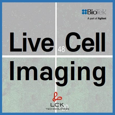 Live Cell Imaging / 생세포 이미지 분석 : 네이버 블로그 Biology Diagrams