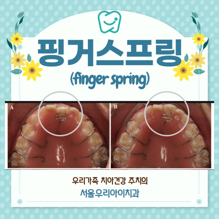 finger-spring