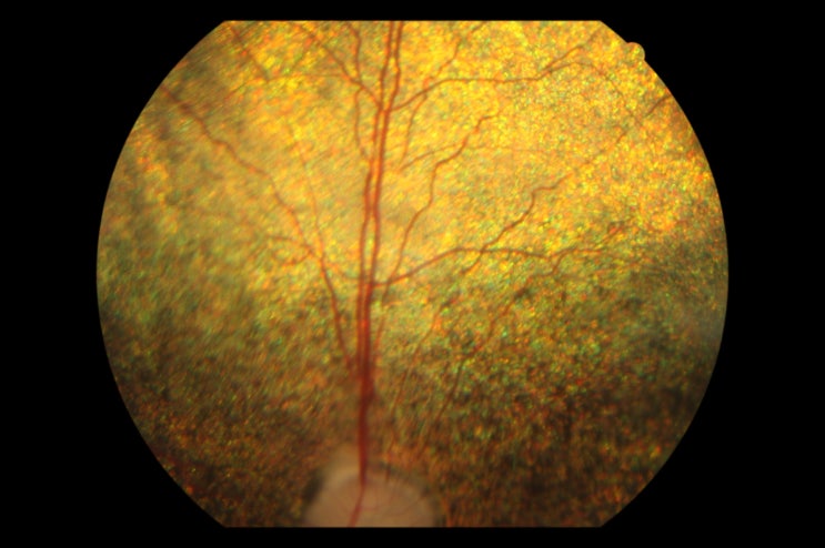 진행성 망막 위축증 (PRA: Progressive retinal Atrophy) : 네이버 블로그