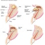 치근단수술 Periapical Surgery