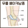 무릎 뒤쪽 통증 - 베이커낭종 증상을 보겠습니다! #새움병원