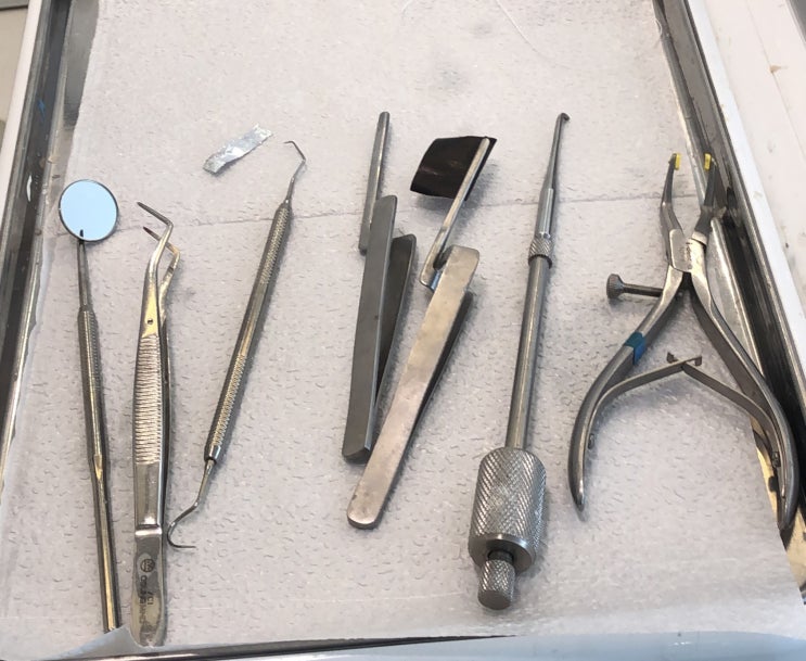 Implant crown setting : 네이버 블로그