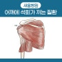 어깨 석회성건염 증상보고 어깨병원에서 치료받기 <새움병원>