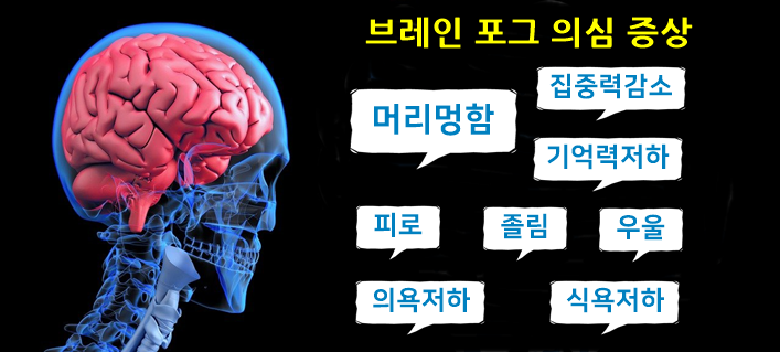 머리가멍해요, 브레인포그(Brain Fog)증상|치료 자가진단 테스트 : 네이버 블로그