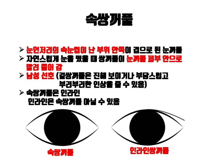 쌍꺼풀 수술 후 헷갈리는 겉쌍, 속쌍, 무쌍의 차이 완벽히 알려 드려요!!! : 네이버 블로그