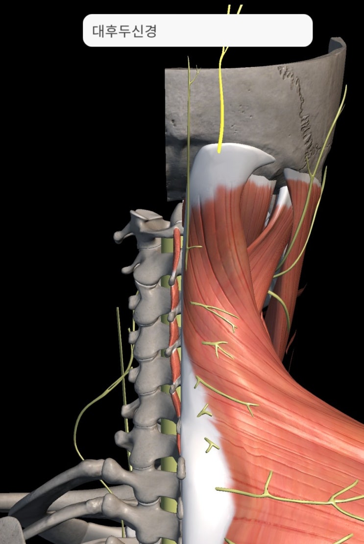 경추성 두통, 경추 원인성 두통(cervicogenic headache) - 안양한의원 : 네이버 블로그
