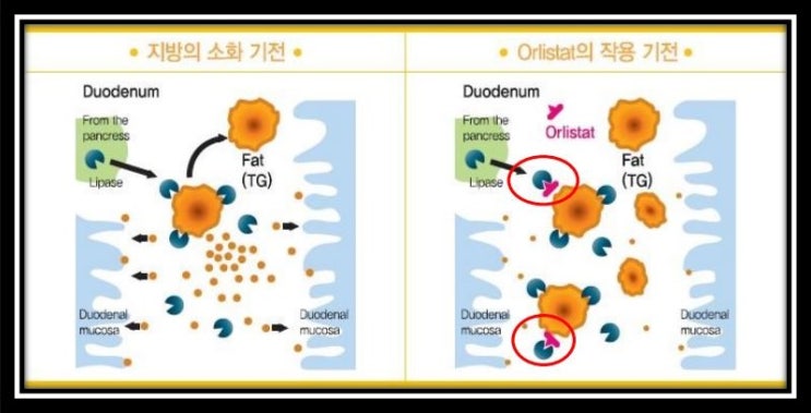 비만치료제 - 지방흡수 억제제 : Orlistat