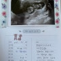 쌍각자궁/임신12주/기형아검사/성별확인시기/임신16주/태아보험 넣기