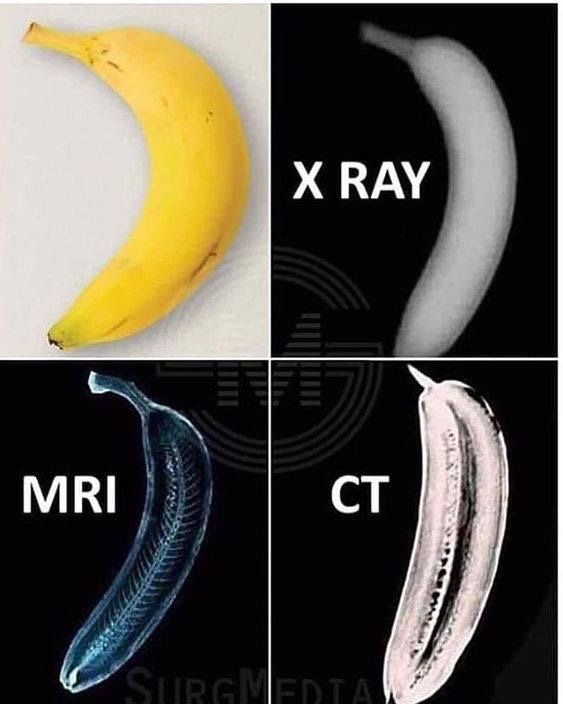 X-ray, CT, MRA, MRI, PET SCAN의 차이 / 영상 의학 검사 차이점 : 네이버 블로그