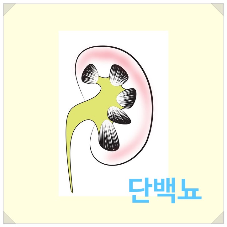 요단백 수치 단백뇨 거품뇨 의미는? : 네이버 블로그