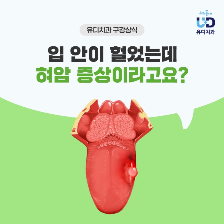 입 안이 헐었는데 혀암(설암)초기 증상이라고요? : 네이버 블로그